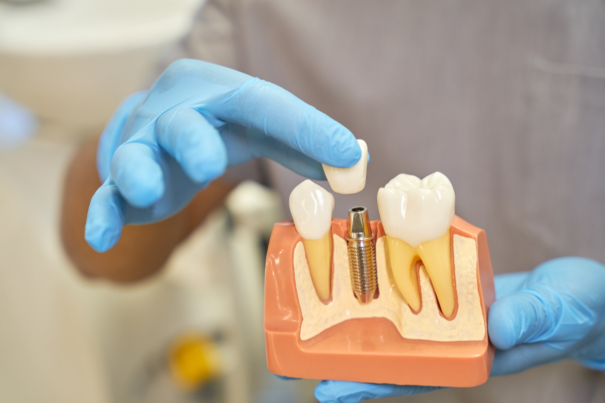 plastic-prop-teeth-implant-being-shown-by-dentist_386185-1612